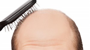 Baldness Breakthrough