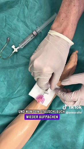 Intravenöser Zugang: Schritt-für-Schritt Anleitung