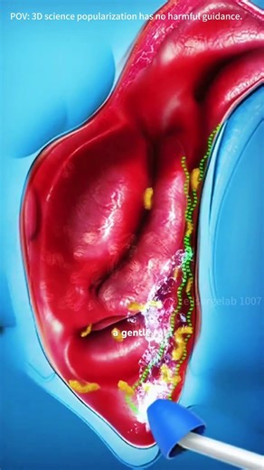 Sinus Rinse Procedure 3D Animation #sinusrinse #sinusrinses #sinusblockage #nasalirigation