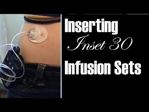 How to Insert the Inset 30 Insulin Pump Infusion Sets + Site Change | Animas Ping