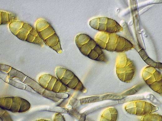 Alternaria alternata - Alchetron, The Free Social Encyclopedia