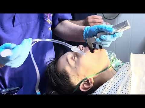Anesthesia for Lapratomy in younger patients #anesthesia