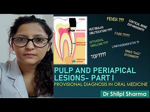 Pulp and periapical lesions - Part I (in Hindi)। Chairside Diagnosis