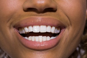 World Toothache Day: 10 important facts about oral health
