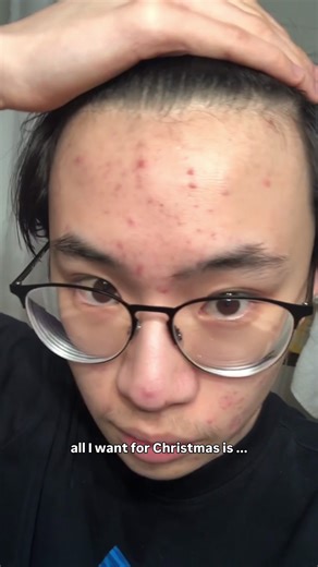 Achieve Glass Skin: My Annual Wish List