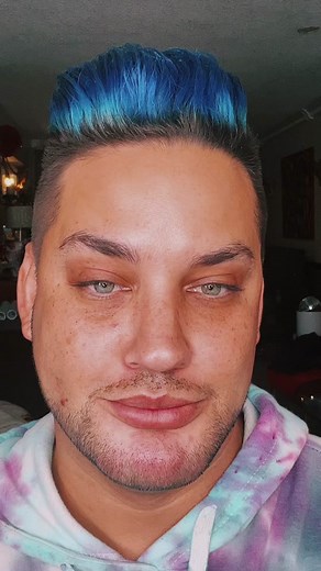 How to Cover Up Bob's Pimples | Makeup Tutorial