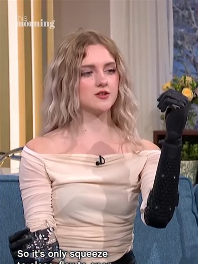 Tilly's Incredible Wireless Bionic Hands Demonstration