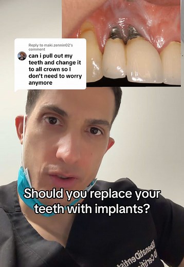 Dental Implants: Should You Replace Your Teeth?