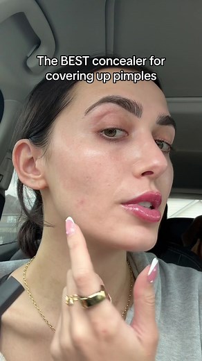 I’ve been using this concealer for about 7 years now & it truly does the best job at covering up stubborn acne! #acnemakeup #acnemakeuproutine #acnemakeupcoverage #acnemakeuptutorial #coveringupacne #concealer #concealerhack #concealertips #concealerforacne #narsradiantcreamyconcealer #acne #acneskin #acnetips
