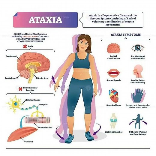 🧠 What Is ATAXIA? Symptoms, Causes & How Physiotherapy Helps | Complete Awareness Guide|| #physio