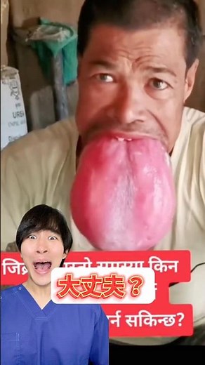 Explaining macroglossia