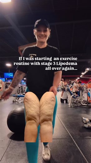 Sarah Whitlow || Founder: Lipedema Movement & Fitness LLC on Instagram: "Looking for a full plan that’s Lipedema friendly? My Lipedema Workout Guide & Conservative Care Blueprint is stage based and mobility based, helping you build a full plan to lighten those legs & keep moving forward. Comment “BLUEPRINT” for the link! 🫶🫶 If I had to start all over again at stage 3 with heavy legs, this is the exact workout I’d do 👇 1️⃣ Assisted Calf Raises – start here to gently pump fluid out of the lower