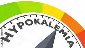 hypokalemia level measuring device animation.zoom effect.Infographic gauge, tachometer, speedometer.