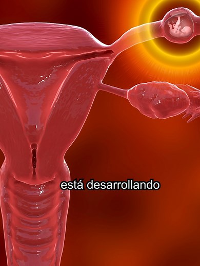 Embarazo Ectópico: Síntomas y Diagnóstico Preciso