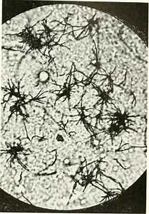 Actinomycetes - Definition, Classification/Characteristics and Culture