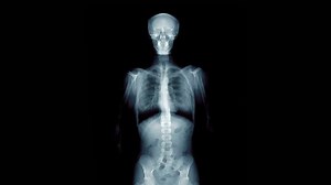 Skeleton Moving Chest X-rayanimation Breathing Chest Stock Footage Video (100% Royalty-free) 17946868 | Shutterstock