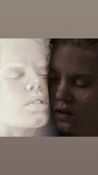 *JOURNÉE DE L'ALBINISME* Maladie remativement méconnue, l'albinisme est suscitée par un défaut de production de la mélanine, substance qui donne sa couleur à notre peau. La mélanine a aussi un rôle protecteur de la peau par rapport aux attatques des rayons ultraviolets du soleil. Elle contribue, chez les sujets sains, au développement du système nerveux visuel et de la rétine. Le défaut de production de mélanine, comme chez les albinos, a plusieurs conséquences possibles : 1°Dépigmentation parti