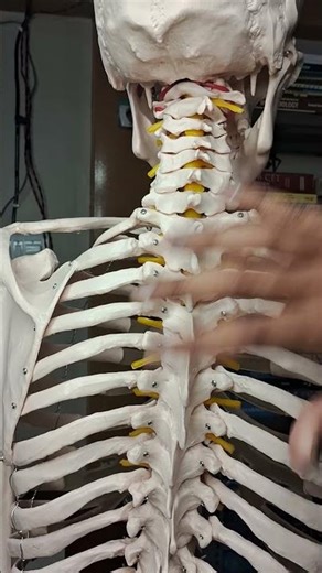 Classification of Vertebrae #rguhs #mentorship #shimoga