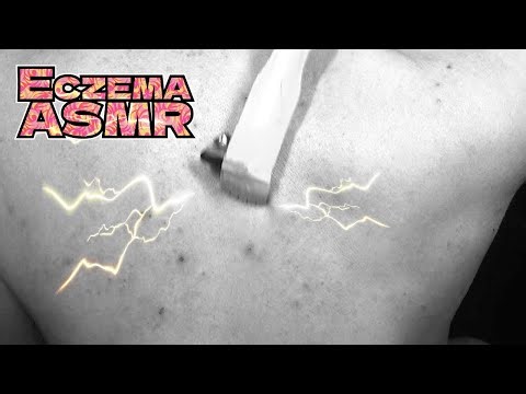 【Eczema ASMR】The sound of scratching an itchy back with a backscratcher/Relaxing effect[Monochrome]