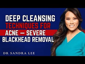 Deep Cleansing Techniques For Acne — Severe Blackhead Removal.[ DR SANDRA LEE]