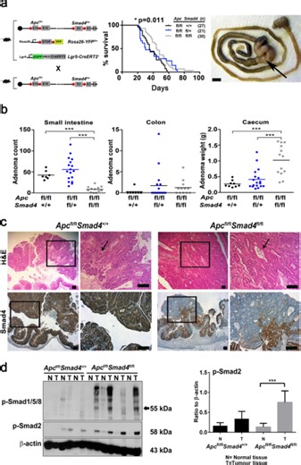 Smad4 and TGFβ1 dependent gene expression signatures in conditional intestinal adenoma, organoids and colorectal cancer - Scientific Reports