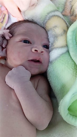 accrocynosis baby and so cute 🥰🥰