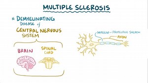 Video: Multiple sclerosis - Video Explanation! | Osmosis | Osmosis