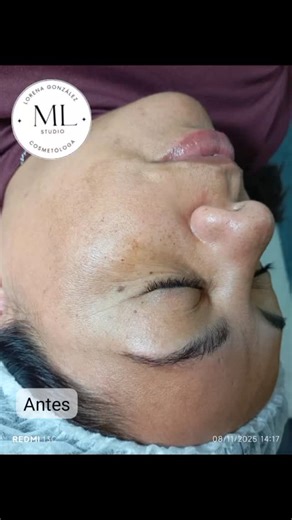 Antes & después de esta carita 朗 @ml_studio_sp | ML Studio | Facebook