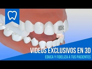 EDUCA A TUS PACIENTES con VIDEOS AMIGABLES odontológicos en 3D 😄