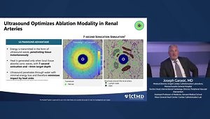 Mechanism and Unique Benefits of Ultrasound Renal Denervation (uRDN)