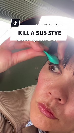 How to Prevent and Treat Styes for Healthy Eyes