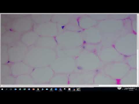 Anatomy & Physiology 1: Loose Connective Tissue - Adipose Connective Tissue