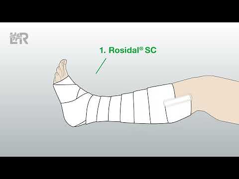 Rosidal® TCS Two-component compression system