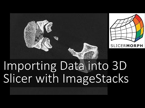 Importing Data into 3D Slicer with ImageStacks
