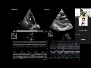 2023 03 12 20 10 35 Constrictive vs Restrictive pericarditis by Dr Rakesh Gupta