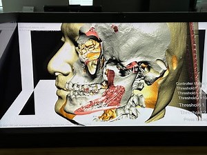 The DSR View, the DICOM 3D viewer for education, research, and explanation to patients