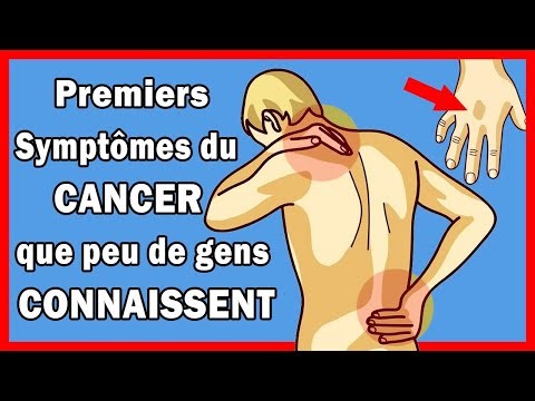 10 Symptoms and Signs of Cancer - Knowing Them Early Can Save Your Life
