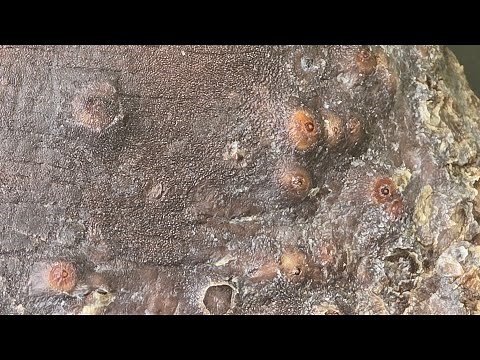 Ebole's follow up jigger digging - Day One #1 - watch long video @ riseupsociety.net & ruskenya.org