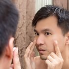 Blue Light Therapy for Cystic Acne