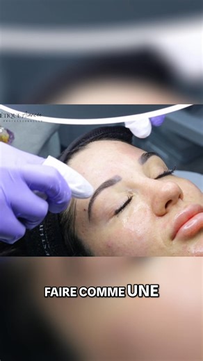 Technique de pro pour retirer les comédons! Il faut retirer le comédon en faisant un J pour atteindre le follicule pileux en profondeur et le repousser vers l'extérieur. Pour plus de conseils pros sur l'esthétique, suivez nous! www.esthetiqueavancee.ca info@esthetiqueavancee.ca #extractioncomedons #soinvisage #beauté | École Professionnelle d'Esthétique Avancée