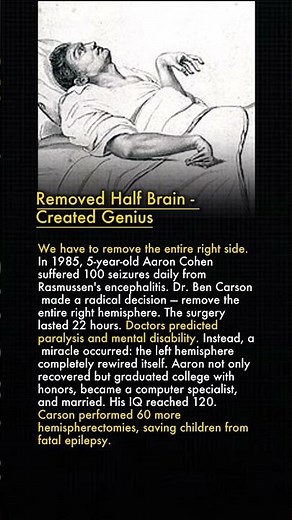 🏥 Surgeon Removed 40% of Child's Brain and Made Him a Genius 🧠✨