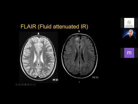 Beyin MR: Temel sekanslar (1)