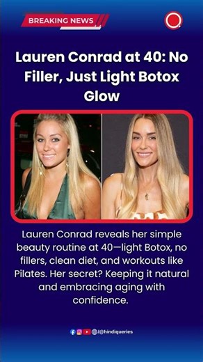 Lauren Conrad at 40: No Filler, Just Light Botox Glow #LaurenConrad #BeautyRoutine
