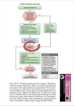 PALS bradycardia algorithm #pediatrics #neetss #shorts