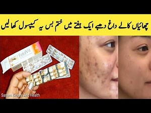 How To Remove Pigmentation By Sanam Ansari | Fefolvit Capsules || Best Vitamin ||