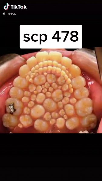 SCP 478-34: Tajemnice Ćmy Euclida