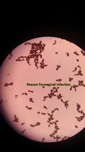 “A microscopic look at the fungus responsible for Candida infection#Microbiology#science #LabLife