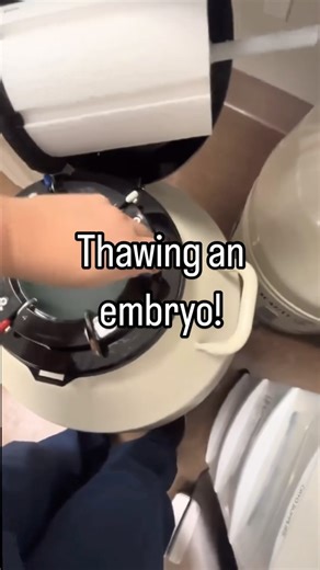 See how an embryo is thawed during an IVF cycle! Embryos are frozen on individual devices and stored inside cryotanks filled with liquid nitrogen, which remains at around -196 degrees Celsius. This prevents any cellular activity from occurring, so the embryo doesn’t develop while it’s frozen. To thaw the embryo, the device is removed from the liquid nitrogen storage tank and placed into a smaller container filled with liquid nitrogen. While the device remain under liquid nitrogen, the cap on the