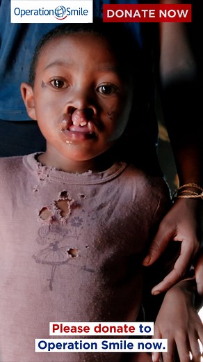With your help, we can change lives and give children with a cleft a new smile. | Operation Smile UK