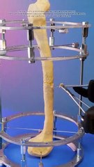 Real medical situations explained simply #fblifestyle